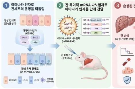 "술꾼들 간도 새것처럼?"…손상된 간 되살린 '기적의 유전자' 정체