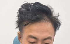 "1000만 탈모인 고민 대통령이 해결해주세요"…박명수 때아닌 호소