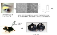 눈꺼풀 줄기세포로 당뇨 치료한다