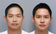개그맨 김형인, 성형수술 받고 '확 달라졌네'