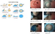 인천 나은병원 위·대장암 내시경 수술장비 도입