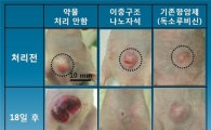 '나노전지'로 암세포 사멸…동물실험서 입증