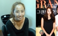 '슈스케2' 최은, 양악수술 변신…"이러다 국민수술 될 듯"