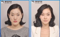 양악수술 '수술계획-집도-교정' 종합플랜이 중요