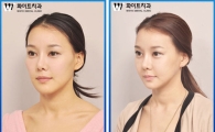 생활 불편 최소화하는 무고정 양악수술