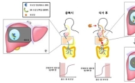 "간세포 내 혈당 조절 원리 밝혀..인슐린 한계 극복 가능" 