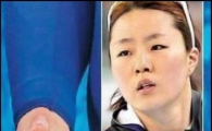 이상화 발 사진, 발바닥에 굳은 살 가득…'뭉클'