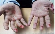 한강 투신 20대 청년 살린 경찰의 ‘상처투성이 손’