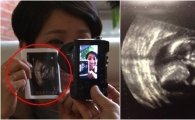 김송 임신, 결혼 10년만의 아기…"정말 감사하다"
