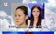 렛미인 방미정, 성형으로 '울상언니'서 병원 코디로 '반전미모'