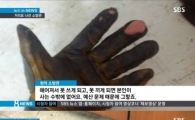 소방관 릴레이 시위 "사비 털어 안전장비 구입" 예산 열악