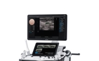 삼성메디슨, 프리미엄 초음파 진단기기 출시 