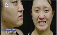 렛미인4 김진, 성형 후 우울증도 사라져 "기적 같은 변화"