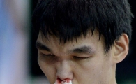 [포토]쌍코피 흘리는 하승진
