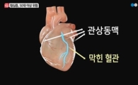 국민 100명 중 1명 협심증, 가슴 쥐어짜는 통증 있다면?…원인 보니 