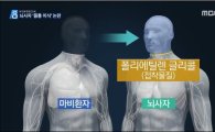 사지마비 환자 '우뚝'…'사람머리 이식'수술 2년 내 현실화되나?