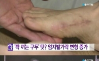 남성 무지외반증 급증, 볼좁은 구두가 원인…"패션보다 건강이 우선"