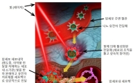 빛과 나노 접목…유전자 항암 치료기술 개발됐다