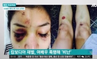 부동산 재벌, 여배우 무차별 폭행…'만신창이 얼굴' 경악