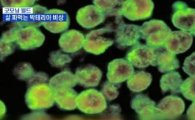 일본 식인 박테리아로 71명 사망 "감염돼 다리절단까지" 