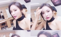 홍진영, 교통사고 질문에 "이제 괜찮다" 안심