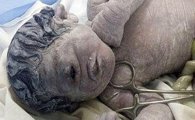 [포토] 이집트서 ‘외눈 아기’ 출생
