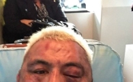 UFC193 마크 헌트, 패배 후 페이스북에 셀카 올린 이유는…