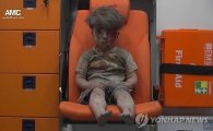 中 매체 “시리아 피범벅 꼬마 영상, 서방 선전전 일환으로 조작 가능성”