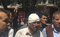 [포토]처참한 아프간 테러 현장…피흘리는 사람들