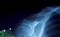 삼성전자, 방사선 피폭량 90% 줄인 엑스레이 소재 개발