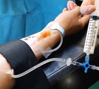 "Videos of Patients Falling Asleep While Counting 'One, Two'... Medical Community Warns It's No Laughing Matter"