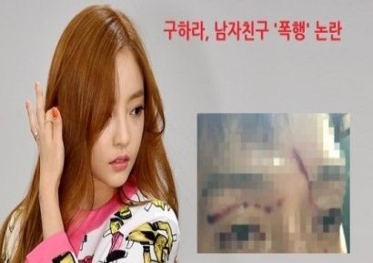 구하라 남자친구 상처 공개…"쌍방 폭행 사실 아냐" 심경 토로