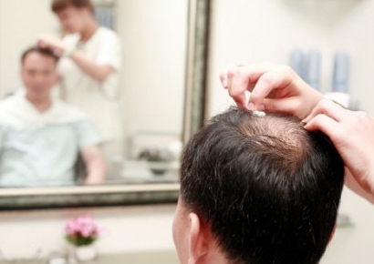 '탈모 걱정' 40대 매일 머리감지 말라?…이런 두피는 꼭