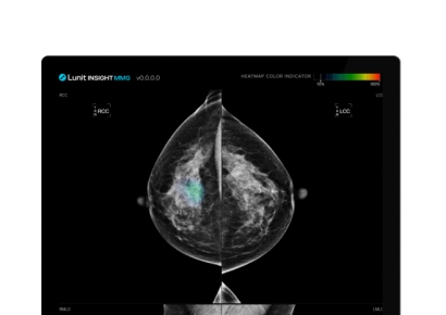 의료 AI 활용, 의료진 업무 부담도 70% 줄인다