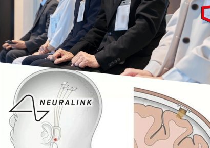 '뇌에 칩 이식' 머스크 뉴럴링크, 임상시험 위한 첫 인간 대상자 모집