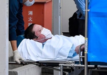 "죽지마, 벌 받아야지" 의사가 악으로 살려낸 日흉악범