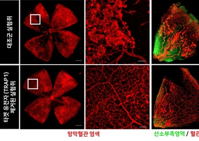 “당뇨망막병, 안약으로 쉽게 치료”… UNIST·KNU 공동연구, 점안형 치료제 개발