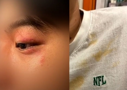 인종차별에 캡사이신 맞은 韓관광객…영사관 "도와줄 게 없다"