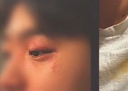 "괴한에게 인종차별·폭행당했는데…외교부 답변에 한숨"