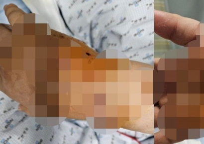 대리운전하던 부부 "차에 있던 맹견에 물렸는데 고객은 우리 탓이라네요"