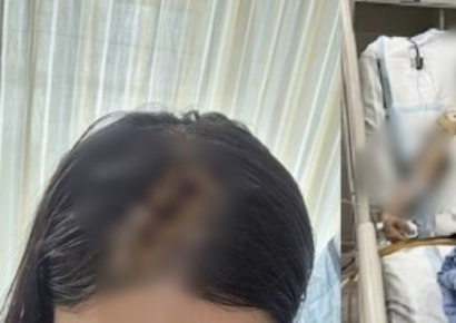 50살도 안된 '그 놈'이 나온다… 매일 지옥을 사는 스토킹 피해자가족