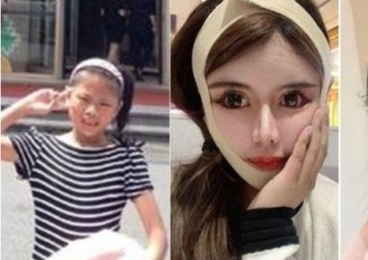'100번 이상 성형' 19살 중국 여성 "더 안한다"…극심한 부작용은 이제부터