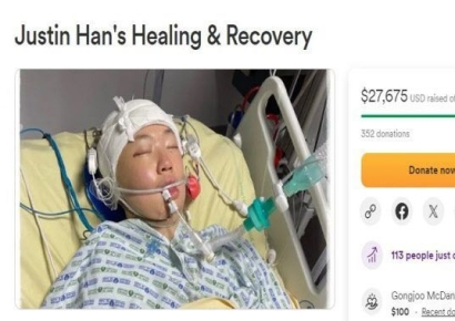 패션·디자인에 관심많던 21살 한인대학생, 파리갔다 무차별 폭행당해