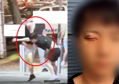 경찰서 코앞에서…호주 한인, 백인 남성들에 인종차별 폭행당해