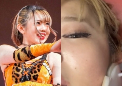 "한국엔 구급차가 없다"…혐한 조장한 일본 여성의 최후