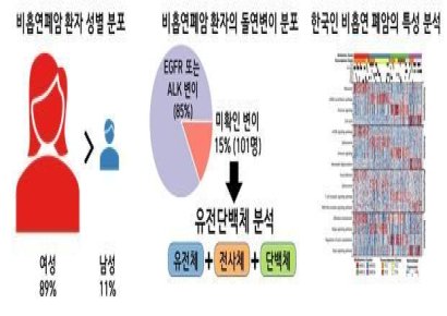 [과학을읽다]실패한 항암제, 韓 여성 비흡연 폐암에 효과