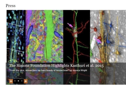 구글·하버드, 쌀한톨보다 작은 조직서 '뇌 지도' 확보