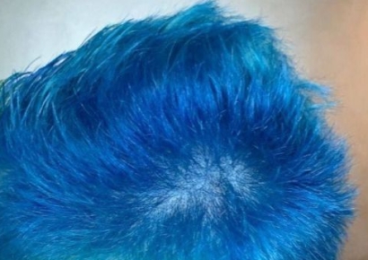 머리 염색이 우크라이나 국기 닮은 러시아 남성…벌금 75만원 