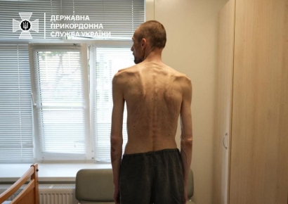 "나치 강제수용소 연상 돼"…뼈만 남은 채 돌아온 우크라 포로