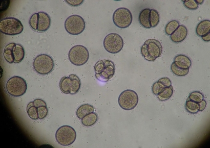 사람 몸까지 올라온 '독해진 곰팡이'…약물도 안듣는 돌연변이 진화